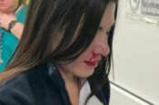 Castellammare di Stabia: infermiera picchiata e colpita con un pugno al volto