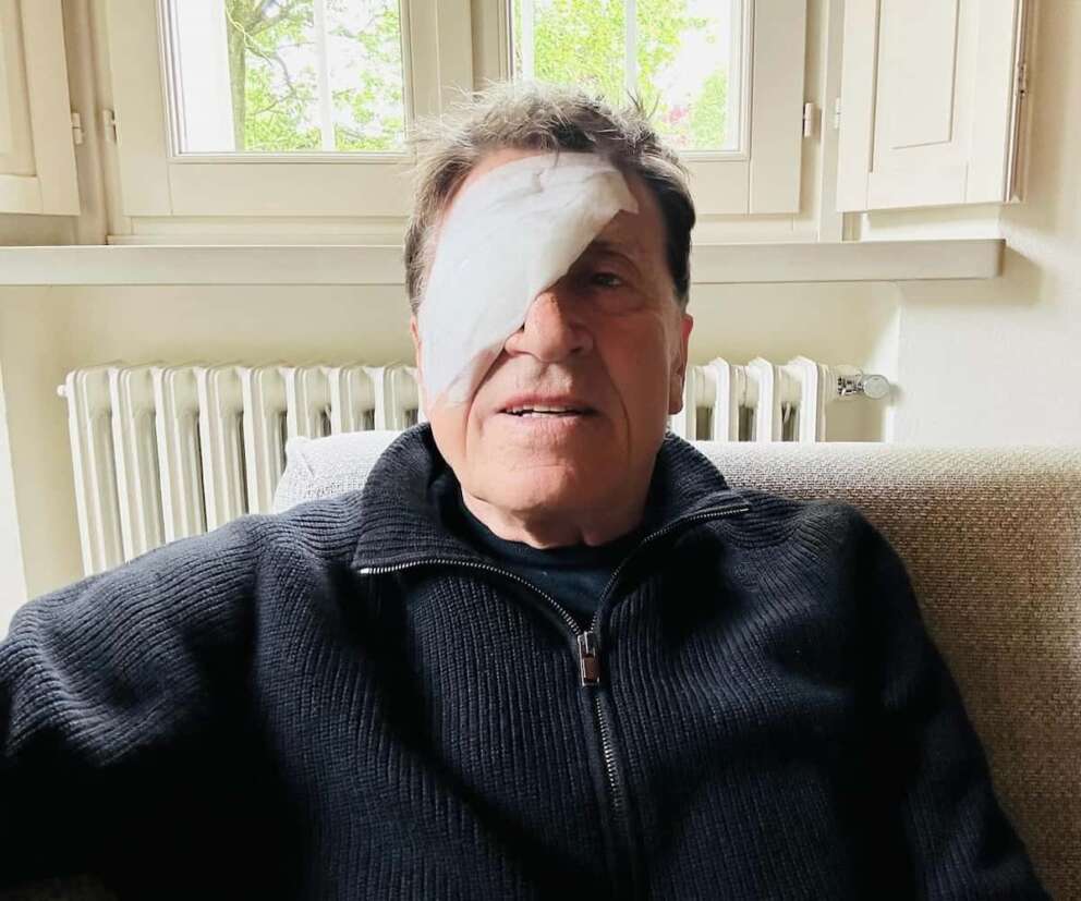Gianni Morandi con l’occhio destro fasciato, foto da Facebook