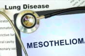 Mesotelioma: cos’è il tumore dell’amianto. Cause, sintomi e possibilità di sopravvivenza