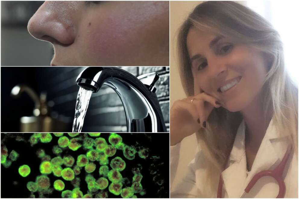 A destra la dottoressa Cristiana Indolfi. A sinistra dall’alto in basso, un naso, l’acqua di rubinetto e Naegleria fowleri, principale vettore della malattia, osservato al microscopio (foto da Wikipedia).
