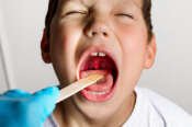 Streptococco: contagio e incubazione. I sintomi con o senza febbre nei bambini e negli adulti